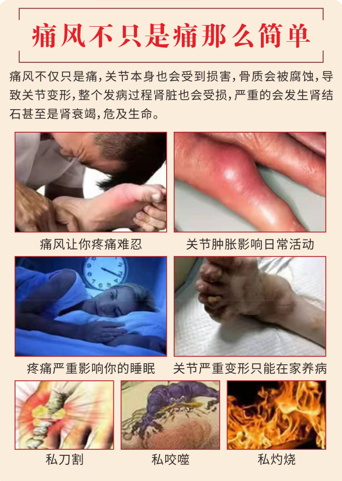 痛風膏4.png