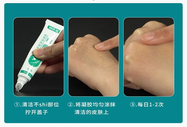 劉醫(yī)堂疤痕醫(yī)用退熱凝膠3.png