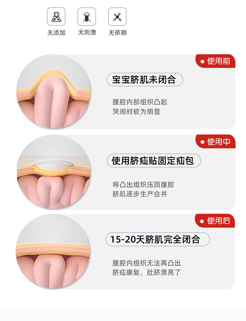 小兒臍貼代加工1000種樣品選擇,小兒臍貼代加工哪家好