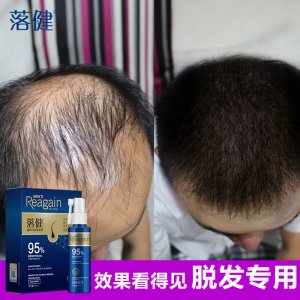 落健育發液定制代加工