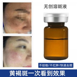 黑色素淡化眞皮斑融斑液 貼牌OEM/ODM