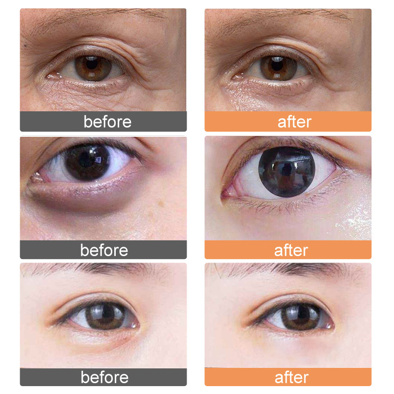 FeDoren 姜黃眼霜去除黑眼圈眼袋OEM代加工