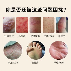 皮膚抑菌膏OEM代加工源頭工廠